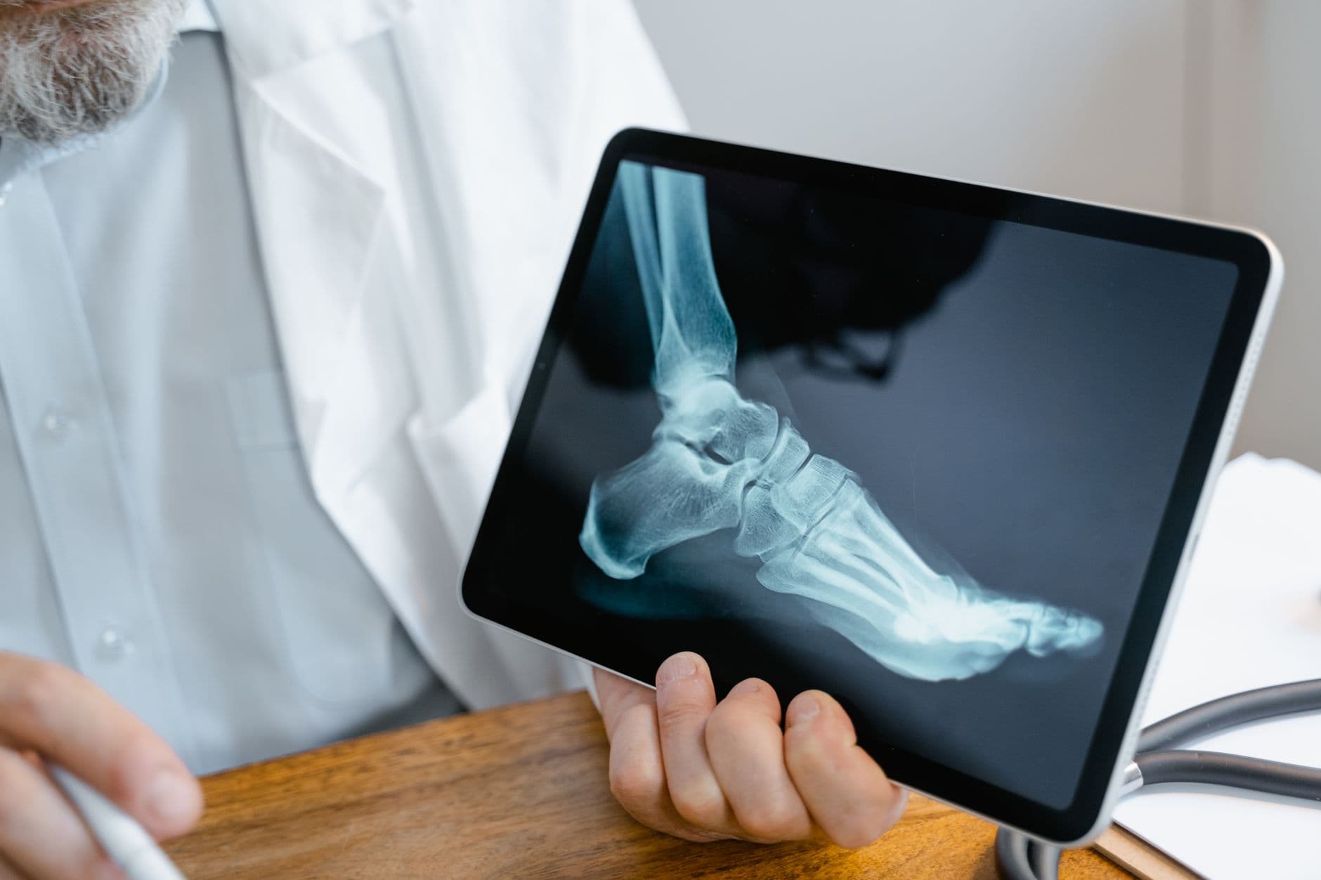 Doctor examining a foot x-ray on a tablet